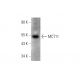 MCT11 Antibody (G-4) - Western Blotting - Image 344271 