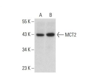 western blotting image from recommended MCT2 (D-5) monoclonal antibody replacement. Image 127066
