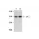 This polyclonal antibody has been discontinued. See our recommended <a href="mct2-antibody-d-5">MCT2 (D-5)</a> monoclonal antibody (sample data shown). western blotting image from recommended MCT2 (D-5) monoclonal antibody replacement. Image 127066