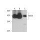 This polyclonal antibody has been discontinued. See our recommended <a href="mct4-antibody-d-1">MCT4 (D-1)</a> monoclonal antibody (sample data shown). western blotting image from recommended MCT4 (D-1) monoclonal antibody replacement. Image 351967