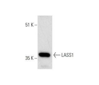 LASS1 (H-170): sc-135033. Western blot analysis of LASS1 expression in MDA-MB-231 whole cell lysate. 