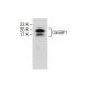 MDA-MB-435S Whole Cell Lysate: sc-364184. Western blot analysis of CGGBP1... 