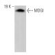 MDGI Antibody (66E2) - Western Blotting - Image 374527
