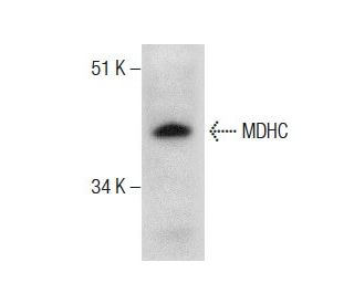 MDHC Antibody (28) - Western Blotting - Image 283899 