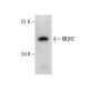 MDHC Antibody (28) - Western Blotting - Image 283899 