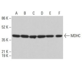 MDHC Antibody (A-4) - Western Blotting - Image 382649 