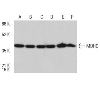 MDHC Antibody (H-6) - Western Blotting - Image 382647 