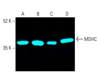 MDHC Antibody (H-6) | SCBT - Santa Cruz Biotechnology