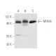 Este anticuerpo policlonal ha dejado de fabricarse. Consulta nuestro anticuerpo monoclonal recomendado <a href="mdm2-antibody-smp14">MDM2 (SMP14)</a> (se muestran datos de muestra). western blotting image from recommended MDM2 (SMP14) monoclonal antibody replacement. Image 31