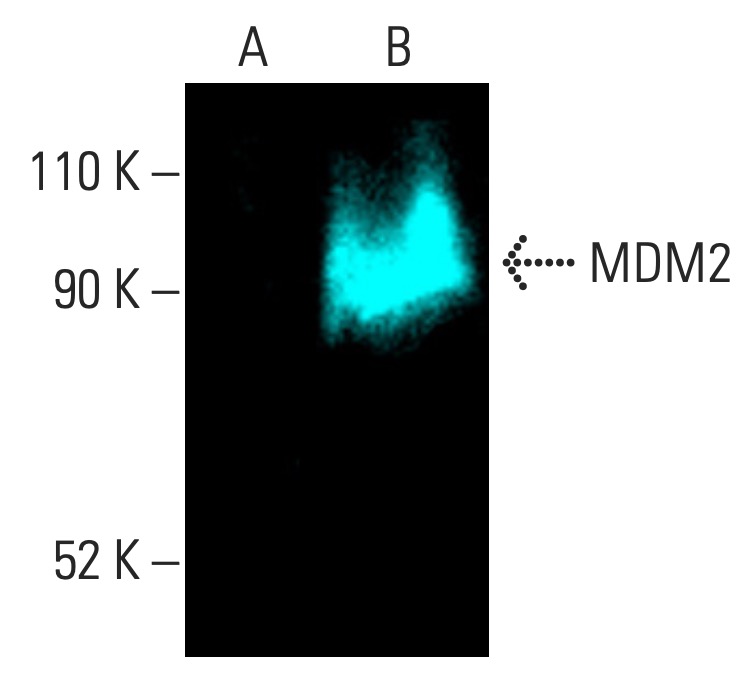 MDM2 Antikörper (SMP14) | SCBT - Santa Cruz Biotechnology