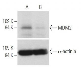 MDM2 siRNA (h): sc-29394. Western blot analysis of MDM2 expression in non-transfected control (A) and MDM2 siRNA transfect 