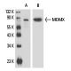 western blotting image from recommended MDMX (G-10) monoclonal antibody replacement. Image 17025