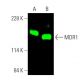 western blotting image from recommended MDR1/ABCB1 (D-11) monoclonal antibody replacement. Image 375249