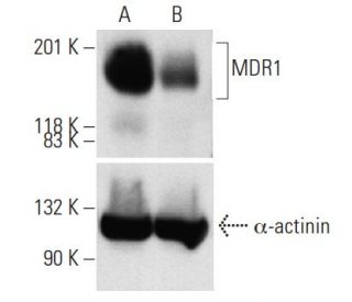 MDR1 siRNA (h): sc-29395. Western blot analysis of MDR1 expression in... 
