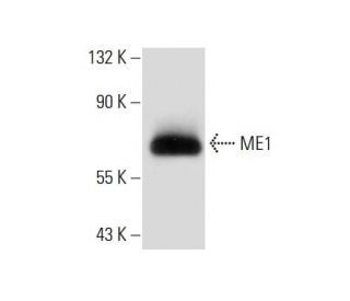 ME1 Antibody (99.1) - Western Blotting - Image 134952 