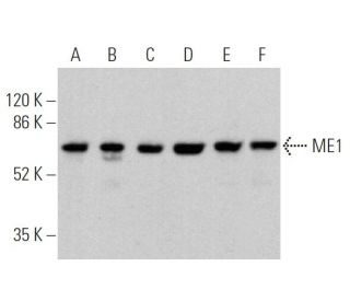ME1 Antibody (C-6) - Western Blotting - Image 360296 