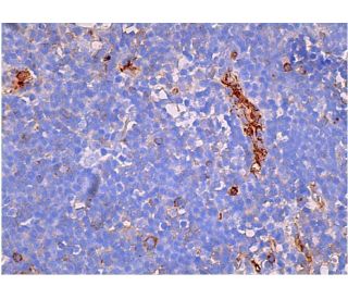 みりあん☺︎⑦ integrin-beta3-antibody-d-11-
