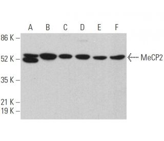 MeCP2 Antibody (G-6) - Western Blotting - Image 359645