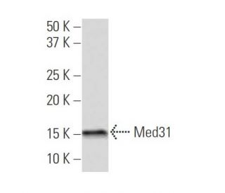 Med31 Antibody (3-9D) - Western Blotting - Image 34551Each CRISPR/Cas9 Knockout (KO) Plasmid product consists of a pool of 3 plasmids designed to ensure identification and cleavage of a specific gene for maximum knockout efficiency. Each plasmid encodes a unique 20 nt sequence derived from the GeCKO (v2) library.