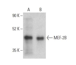 western blotting image from recommended MEF-2B (C-6) monoclonal antibody replacement. Image 400049
