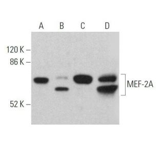 western blotting image from recommended MEF-2A (B-4) monoclonal antibody replacement. Image 359701