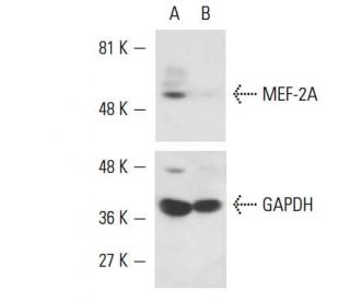 MEF-2A siRNA (h): sc-35894. Western blot analysis of MEF-2A expression in non-transfected control (A) and MEF-2A siRNA tra 