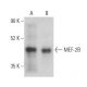 MEF-2B Antibody (C-6) - Western Blotting - Image 400049
