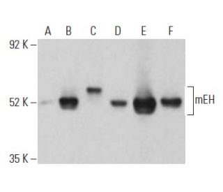 mEH Antibody (17) - Western Blotting - Image 396130 