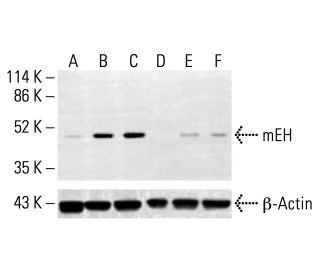 mEH Antibody (17) - Western Blotting - Image 412863