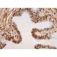 Meis1/2/3 Antibody (9.2.7) - Immunohistochemistry - Image 383495 