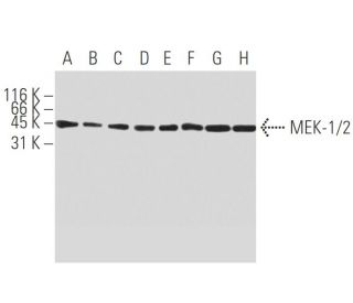 MEK-1/2 Antibody (9G3) - Western Blotting - Image 395898