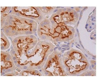 immunohistochemistry image from recommended MEK-4 (G-7) monoclonal antibody replacement. Image 284926