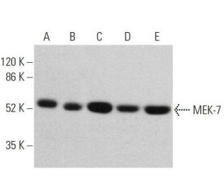 western blotting image from recommended MEK-7 (E-7) monoclonal antibody replacement. Image 359707