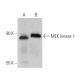 MEK kinase-1 Antibody (1-9C-2A) - Western Blotting - Image 370524 