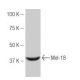 Mel-18 Antibody (9HL1) - Western Blotting - Image 53914
