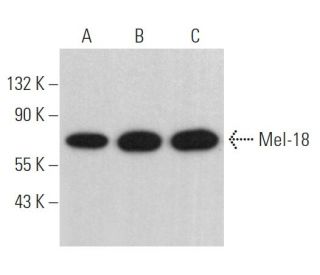 western blotting image from recommended Mel-18 (H-1) monoclonal antibody replacement. Image 367078