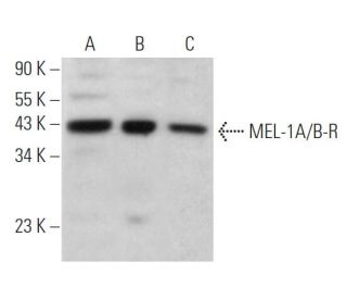 western blotting image from recommended MEL-1A/B-R (B-8) monoclonal antibody replacement. Image 362098