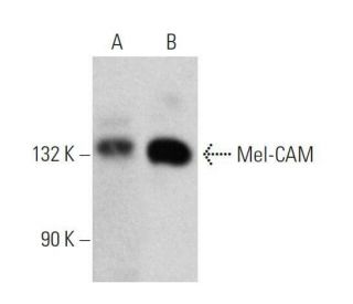 Mel-CAM Antibody (A-9) - Western Blotting - Image 358550Each CRISPR/Cas9 Knockout (KO) Plasmid product consists of a pool of 3 plasmids designed to ensure identification and cleavage of a specific gene for maximum knockout efficiency. Each plasmid encodes a unique 20 nt sequence derived from the GeCKO (v2) library.