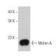 Melan-A Antibody (0.N.397) - Western Blotting - Image 355297 