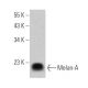 Melan-A Antibody (3H2639) - Western Blotting - Image 355295 