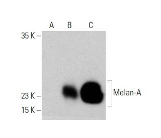 Melan-A Antibody (A103) - Western Blotting - Image 385733 