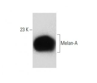 Melan-A Antibody (D-1) - Western Blotting - Image 133164 