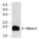 Melan-A Antibody (M2-7C10) - Western Blotting - Image 14354 
