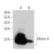 Melan-A Antibody (M2-7C10) - Western Blotting - Image 355290