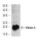 Melan-A Antibody (M2-9E3) - Western Blotting - Image 14355