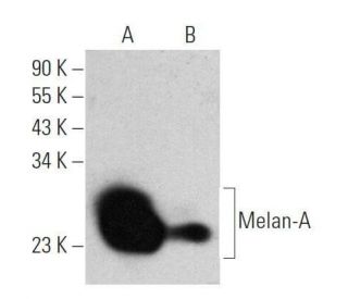 Melan-A Antibody (M2-9E3) - Western Blotting - Image 355289 