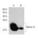 Melan-A Antibody (M2-9E3) - Western Blotting - Image 355289 
