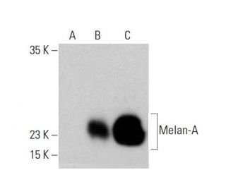 Melan-A Antibody (A103) - Western Blotting - Image 385733
