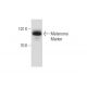 Melanoma Marker Antibody (HMB45) - Western Blotting - Image 147497 