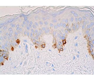 Melanoma Marker Antibody (PNL2) - Immunohistochemistry - Image 388110